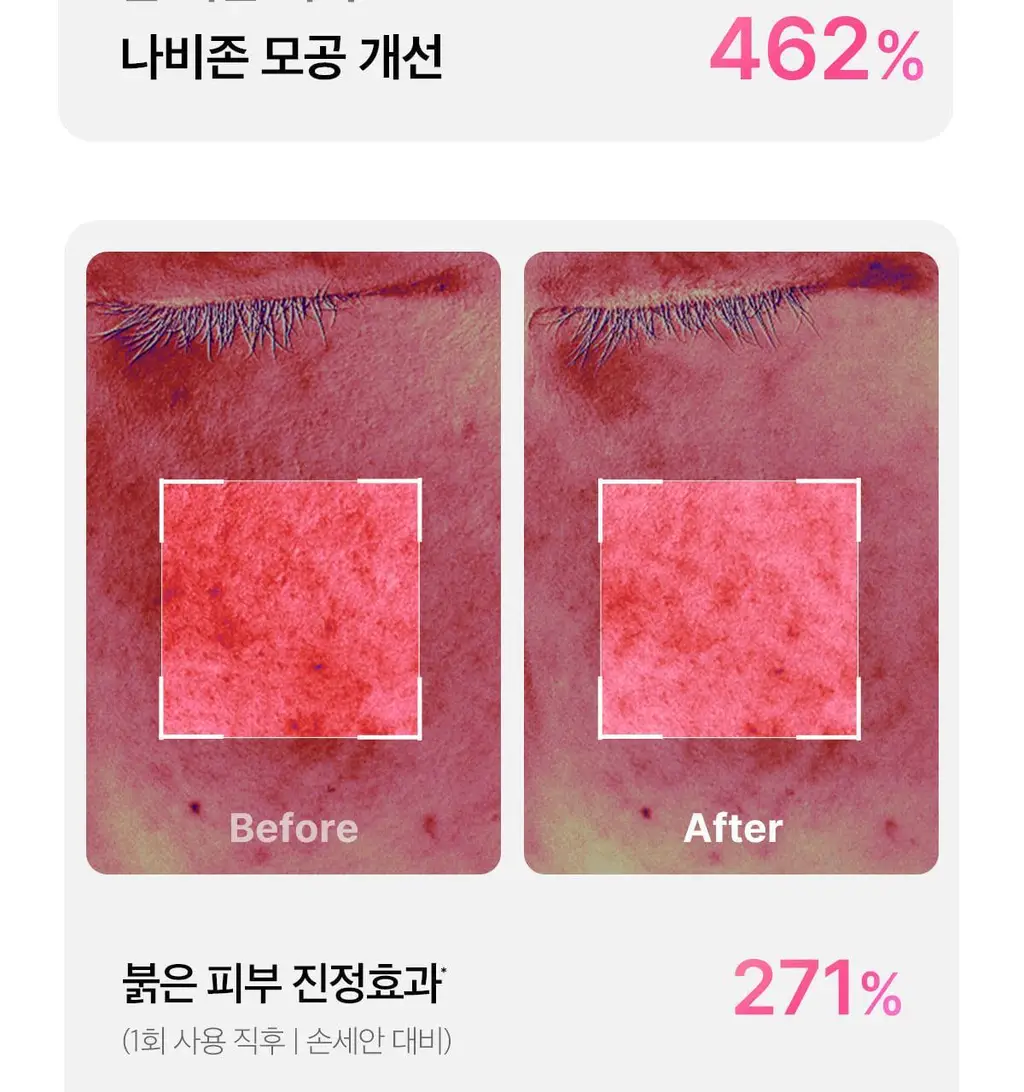 [3D진동클렌징/모공케어] 메디큐브 에이지알 부스터 진동 클렌저 헤드 (베이지/핑크) 상세페이지 31